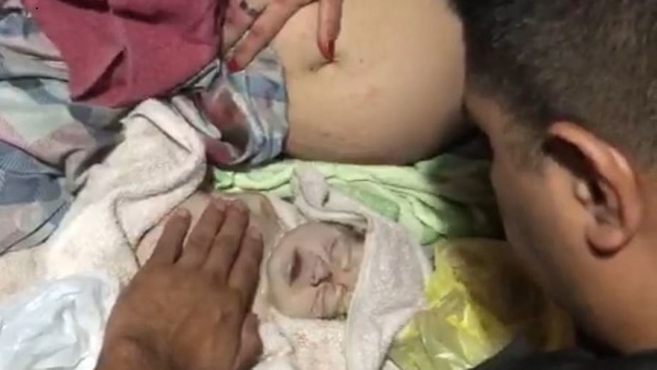 Conmovedor: un policía reanimó a un bebé que había nacido sin signos vitales