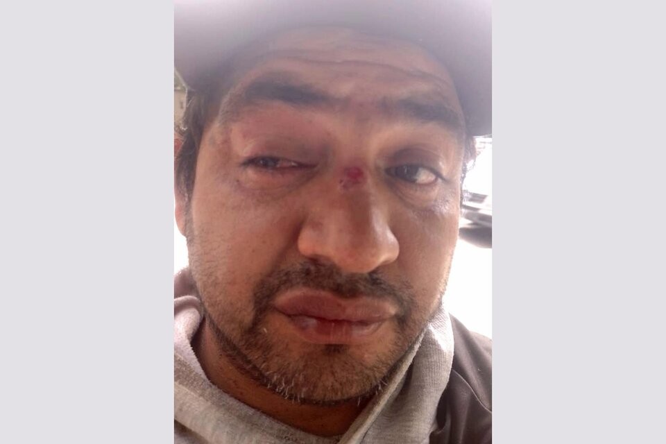 Portocolo antipiquete: un manifestante perdió la visón de un ojo por las represión