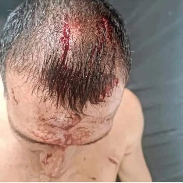 PARAGUAY: Dos hombres fueron atacados por un  yaguareté 