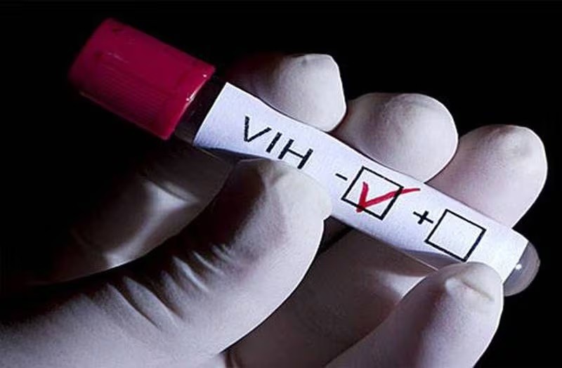 Remarcan la importancia de realizarse el test o prueba del VIH-SIDA